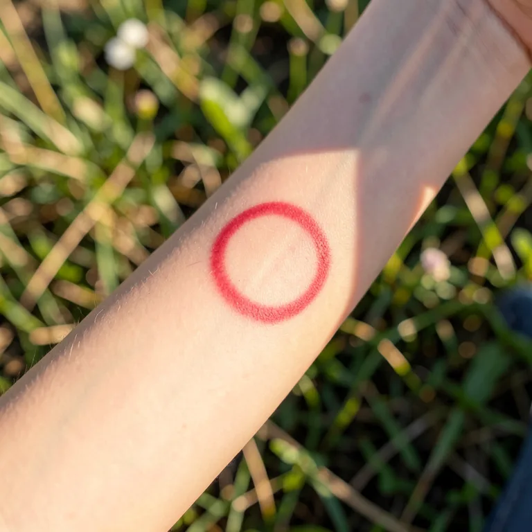 Co je lymeská borrelióza a - ilustrační foto