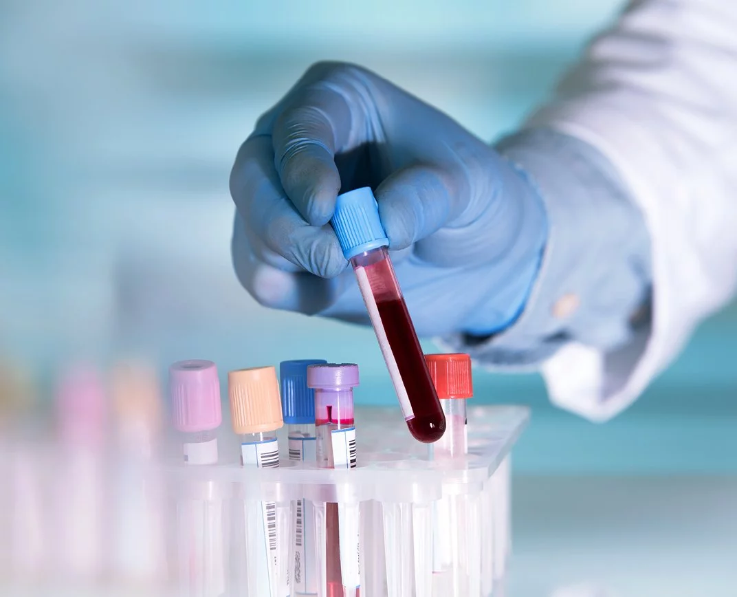 Ruce drží zkumavku s krví nad stojanem pro laboratorní vzorky.