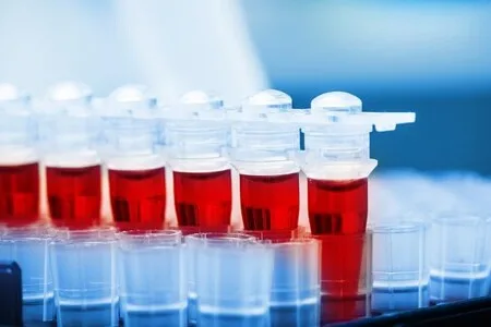 Laboratorní zkumavky s červenou tekutin pro krevní testy.