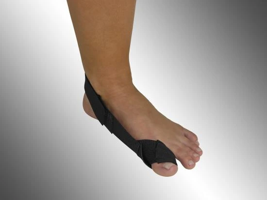 Foot with bunion strap