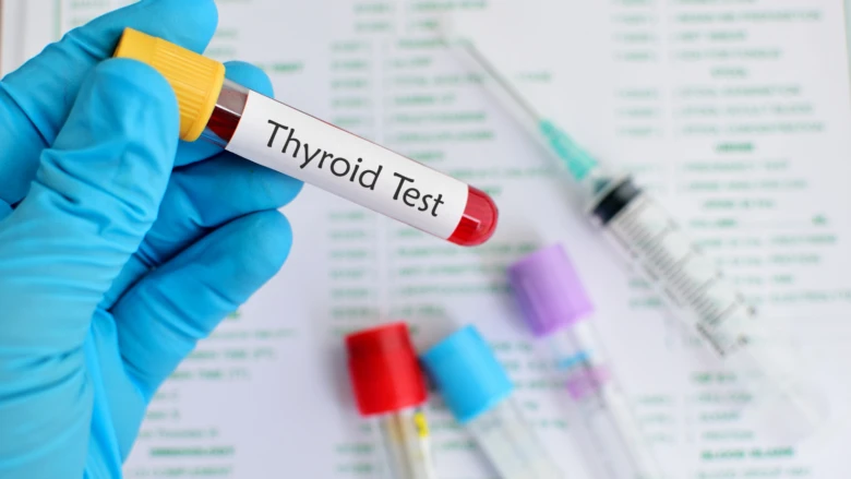 Krevní vzorek pro test štítné žlázy v laboratoři