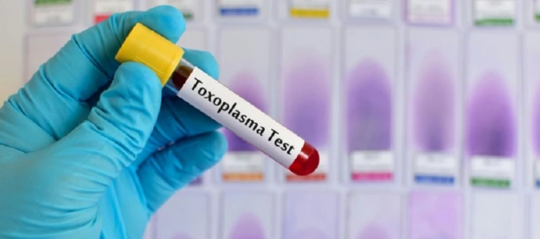 Ruka drží zkumavku s krví pro toxoplazmózu.