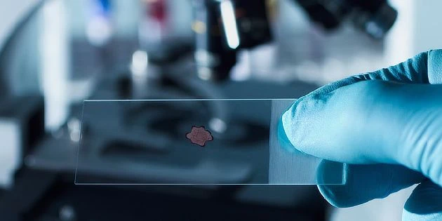 Microscope slide with cell sample