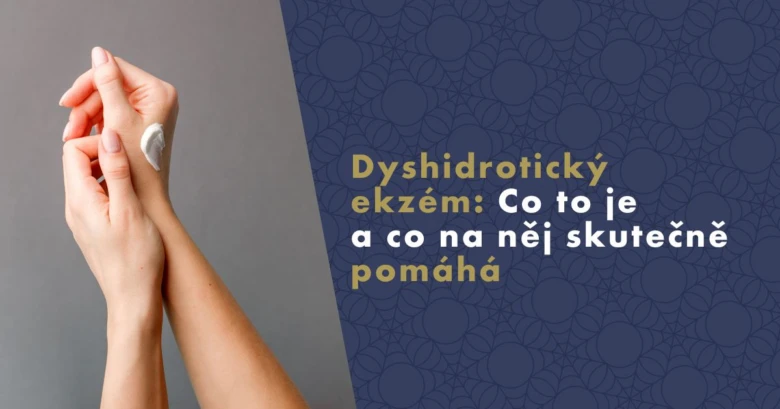 Ruční aplikace krému na ekzém jako domácí léčba.