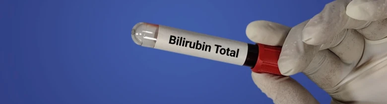 Ruka v rukavici drží zkumavku s krví pro test celkového bilirubinu.