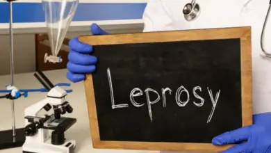 Vědecký pracovník drží tabuli s nápisem lepra v laboratoři.