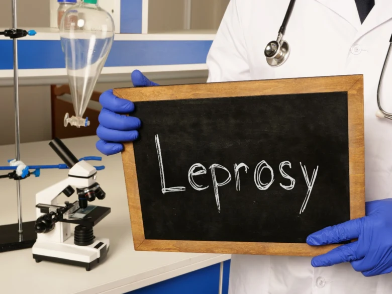 Vědecký pracovník drží tabuli s nápisem lepra v laboratoři.