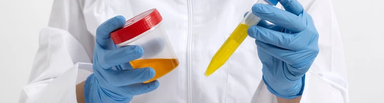 Laborant drží nádobu s močí a zkumavku pro testování.