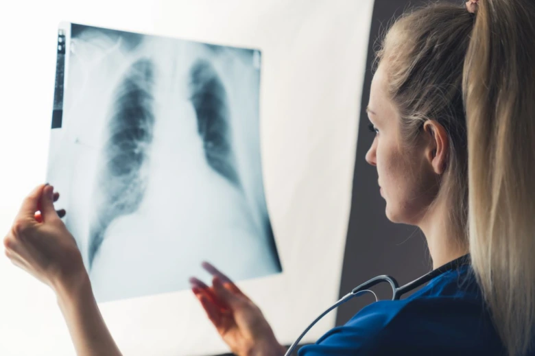 Lékařka zkoumá rentgenový snímek plic pro diagnostiku pneumonie.