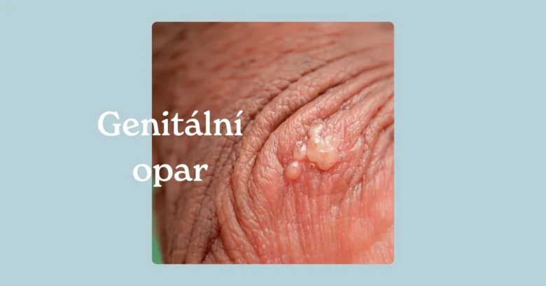 Genital warts on skin
