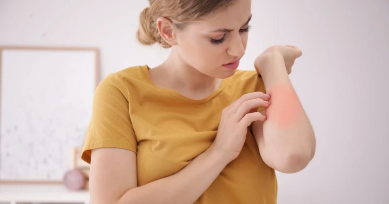 Woman with itchy arm rash