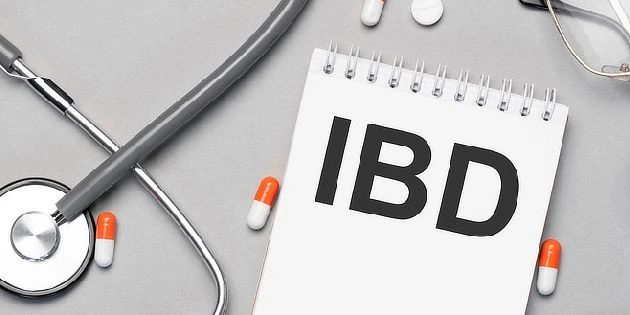 Zápisník s textem IBD, steteskop a tablety na šedém pozadí.